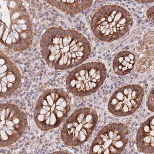 Anti-UQCC3 antibody produced in rabbit 