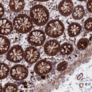 Anti-UQCRB antibody produced in rabbit 