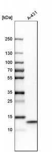 Anti-UQCRB antibody produced in rabbit 