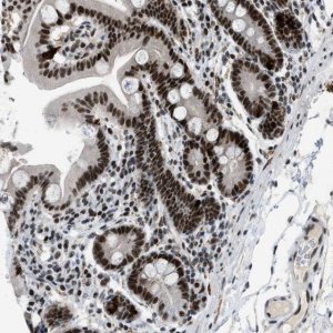 Anti-URB1 antibody produced in rabbit 