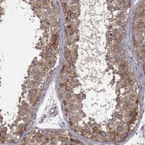 Anti-URI1 antibody produced in rabbit 