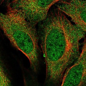 Anti-URI1 antibody produced in rabbit 