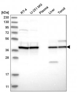 Anti-UROD antibody produced in rabbit 