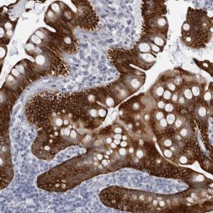 Anti-UROD antibody produced in rabbit HPA028668-100UL