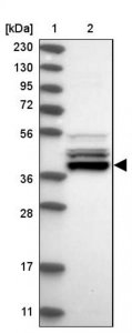 Anti-UROD antibody produced in rabbit HPA028668-100UL
