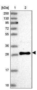 Anti-USE1 antibody produced in rabbit 