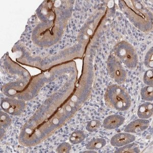 Anti-USH1C antibody produced in rabbit HPA027492-100UL
