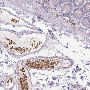 Anti-USHBP1 antibody produced in rabbit 