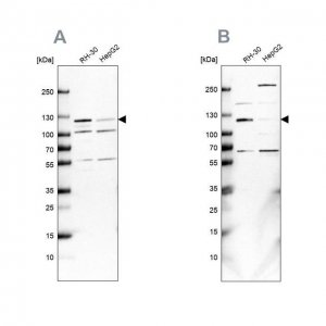 Anti-USP1 antibody produced in rabbit 