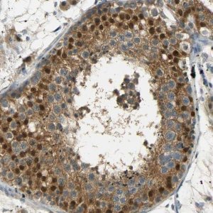 Anti-USP13 antibody produced in rabbit 