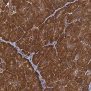 Anti-USP14 antibody produced in rabbit 