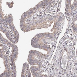 Anti-USP21 antibody produced in rabbit 