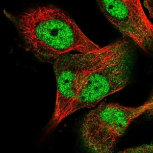 Anti-USP24 antibody produced in rabbit 
