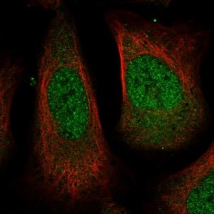Anti-USP24 antibody produced in rabbit HPA026723-100UL