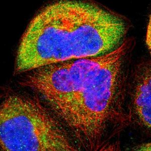 Anti-USP31 antibody produced in rabbit 