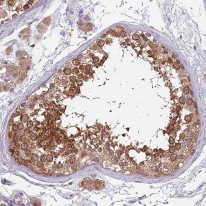 Anti-USP32 antibody produced in rabbit 