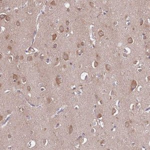 Anti-USP32 antibody produced in rabbit 