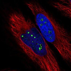 Anti-USP35 antibody produced in rabbit 