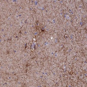 Anti-USP37 antibody produced in rabbit 