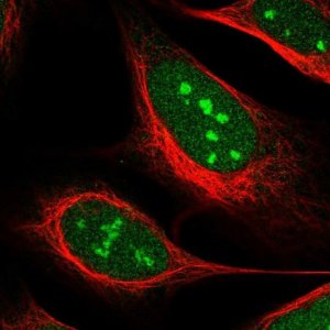 Anti-USP37 antibody produced in rabbit 