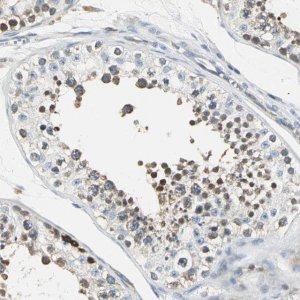 Anti-USP40 antibody produced in rabbit 