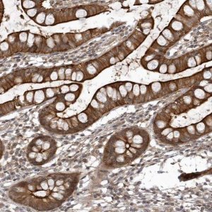 Anti-USP43 antibody produced in rabbit 