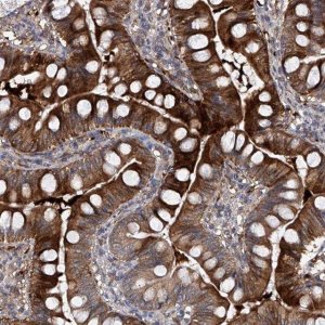 Anti-USP45 antibody produced in rabbit 