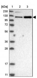 Anti-USP47 antibody produced in rabbit 