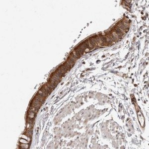 Anti-USP49 antibody produced in rabbit 