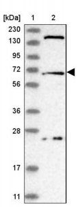 Anti-USP49 antibody produced in rabbit 