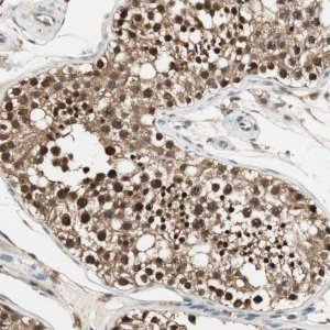Anti-USP5 antibody produced in rabbit 