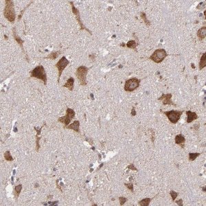 Anti-USP51 antibody produced in rabbit 