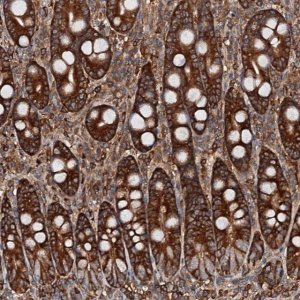 Anti-USP6NL antibody produced in rabbit 