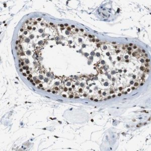 Anti-USP7 antibody produced in rabbit 