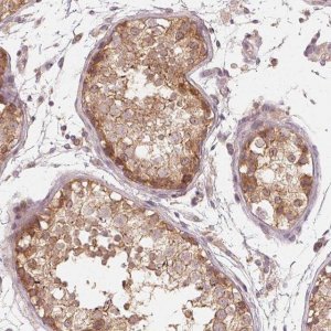 Anti-USP8 antibody produced in rabbit 