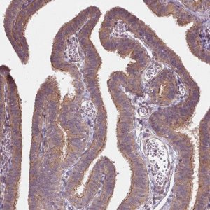 Anti-USP8 antibody produced in rabbit 