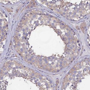 Anti-USPL1 antibody produced in rabbit 