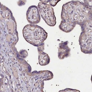 Anti-USPL1 antibody produced in rabbit 