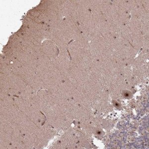 Anti-UTP11 antibody produced in rabbit 