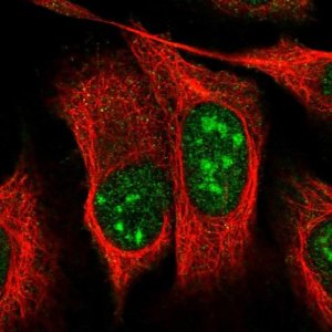 Anti-UTP11 antibody produced in rabbit 