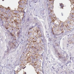 Anti-UTP14C antibody produced in rabbit 
