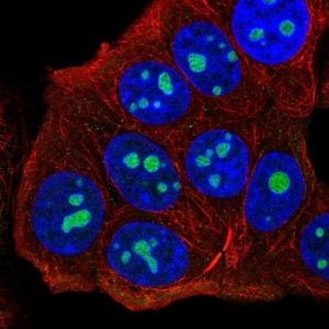 Anti-UTP14C antibody produced in rabbit 