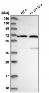 Anti-UTP15 antibody produced in rabbit 
