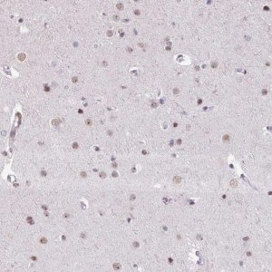 Anti-UTP18 antibody produced in rabbit HPA052378-100UL
