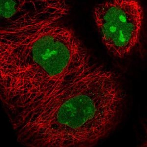 Anti-UTP18 antibody produced in rabbit HPA052378-100UL