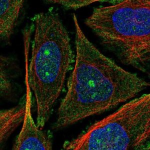 Anti-UTP20 antibody produced in rabbit 