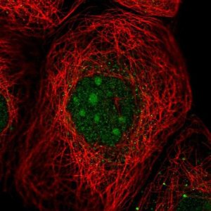 Anti-UTP23 antibody produced in rabbit 