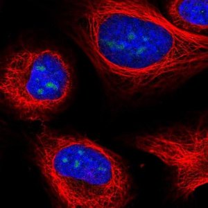 Anti-UTP3 antibody produced in rabbit HPA041453-100UL