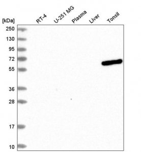 Anti-UTP3 antibody produced in rabbit HPA041453-100UL