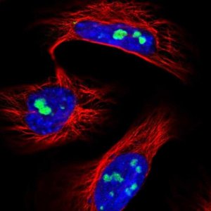 Anti-UTP6 antibody produced in rabbit HPA055806-100UL